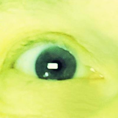 GreenEyes